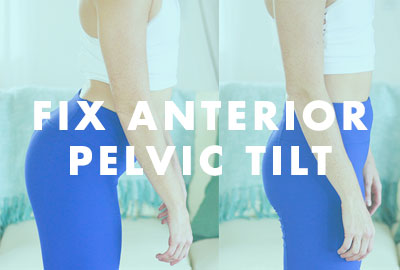 anterior pelvic tilt women